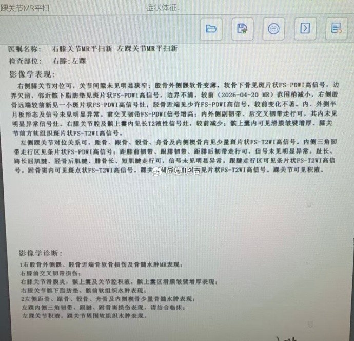 高诗岩双伤确认：右膝前交叉韧带+左踝 近期赴美康复